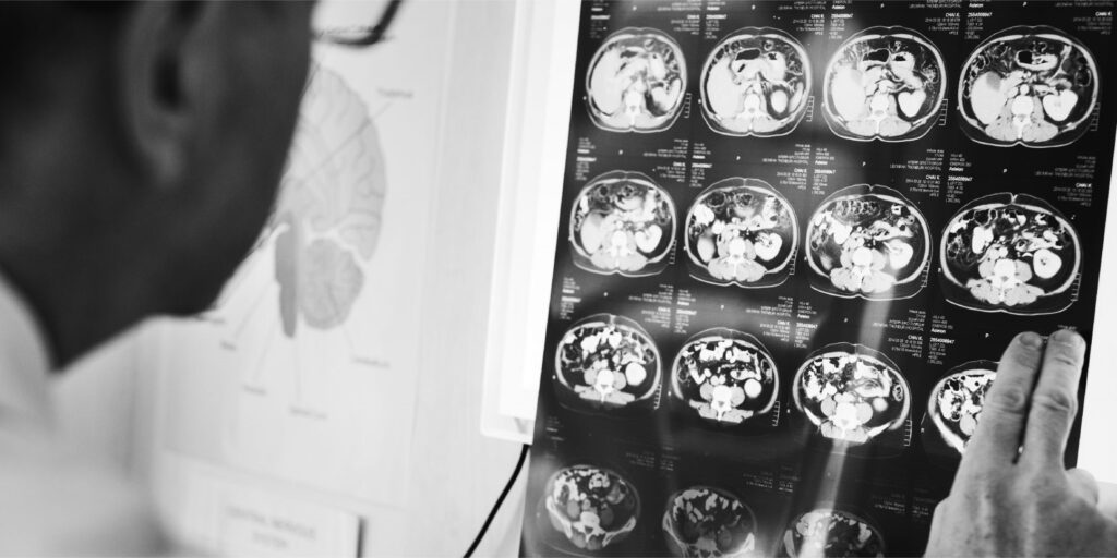 Teleradiology Service